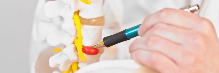 Eagan MN Chiropractor Talks about Bulging Discs